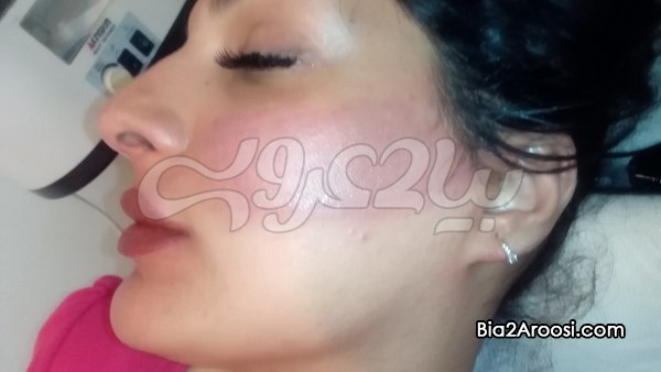 میکروپیگمنتیشن نسرین