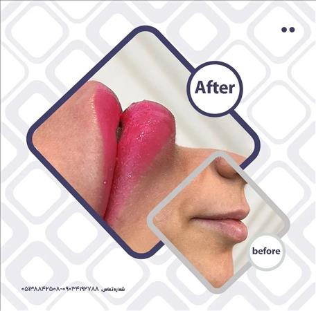 کلینیک زیبایی پالادیوم