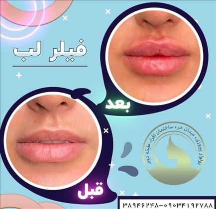 کلینیک زیبایی پالادیوم
