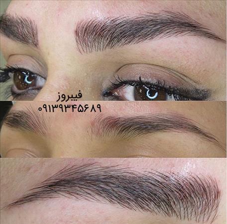 مرکز میکروپیگمنتیشن و فیبروز الناز شجاعی