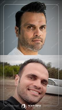 کلینیک زیبایی نوین ایرانا مشهد