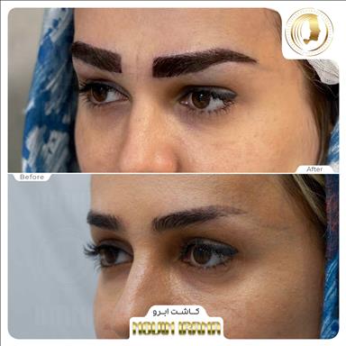 کلینیک زیبایی نوین ایرانا در مشهد