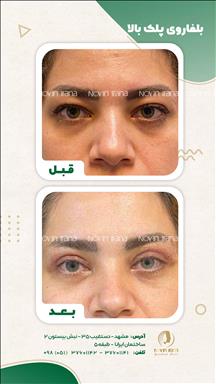 کلینیک زیبایی نوین ایرانا 1