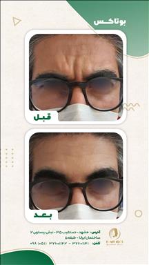 کلینیک زیبایی نوین ایرانا 10