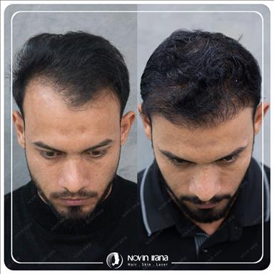 کلینیک زیبایی نوین ایرانا 15