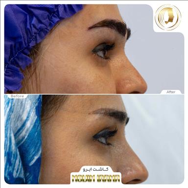 کلینیک زیبایی نوین ایرانا 22