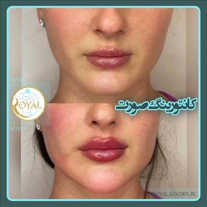 کلینیک زیبایی رویال طلایی