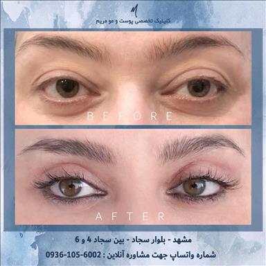 کلینیک زیبایی پوست و مو مریم  در مشهد