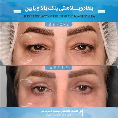کلینیک زیبایی پوست و مو مریم  1