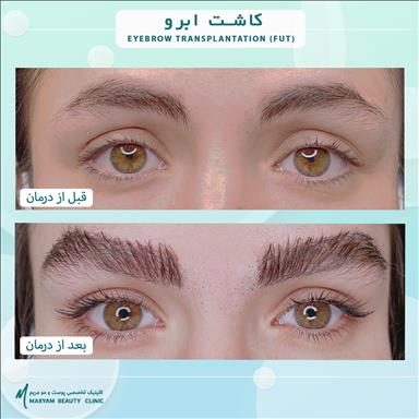 کلینیک زیبایی پوست و مو مریم  2