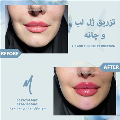 کلینیک زیبایی پوست و مو مریم  3