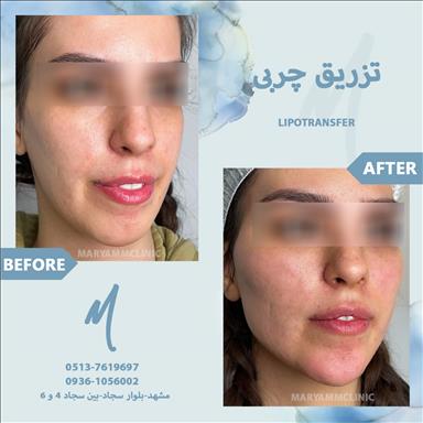 کلینیک زیبایی پوست و مو مریم  4