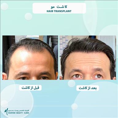 کلینیک زیبایی پوست و مو مریم  5