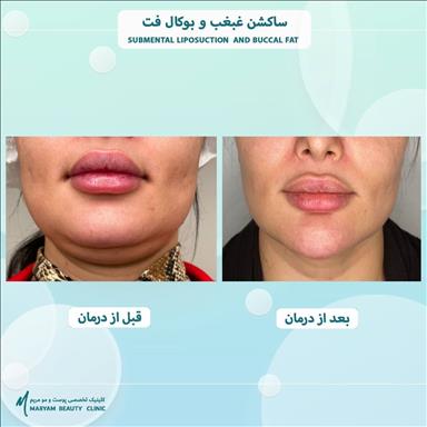 کلینیک زیبایی پوست و مو مریم  12