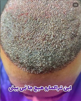 کلینیک پوست و مواکسیرجوانی سایه 2