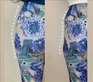 کلینیک پوست و مواکسیرجوانی سایه 3