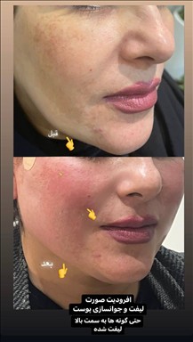 کلینیک پوست و مواکسیرجوانی سایه 5