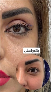 کلینیک پوست و مواکسیرجوانی سایه 6