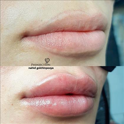 خدمات پوست ناهید گلچین