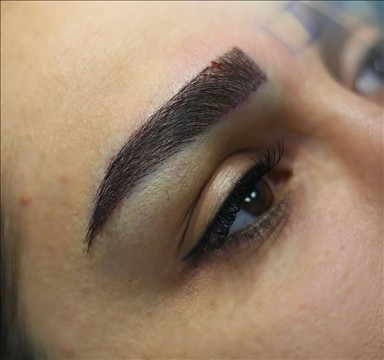 کلینیک زیبایی سایه در مشهد