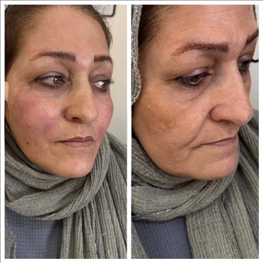 کلینیک زیبایی سایه 2