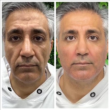 کلینیک زیبایی سایه 5