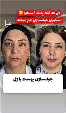 کلینیک زیبایی سایه 8