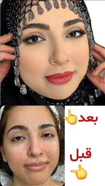 زیبایی بزک 6