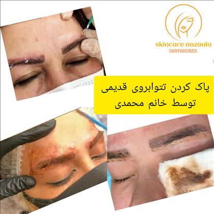 آرایشی وزیبایی بهترینهاروازماب آرایشی وزیبایی بهترینهاروازماب