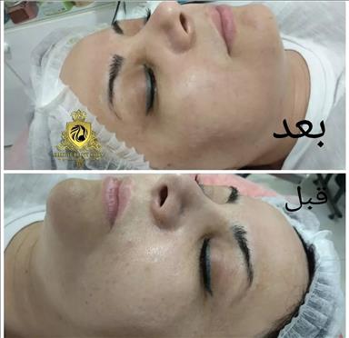 پنجه ی آقتاب بندر انزلی
