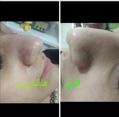 سالن زیبایی بندر انزلی