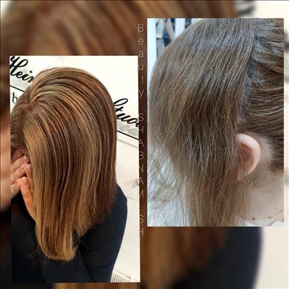 میکرو بلیدینگ شبنم