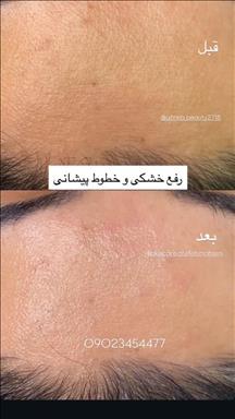 زیبایی آفرینا