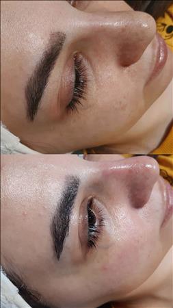 پاکسازی و فیشال فاطمه حبیبی