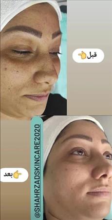 خدمات فشیال زحمتکش
