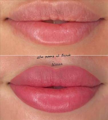 سالن زیبایی آلما