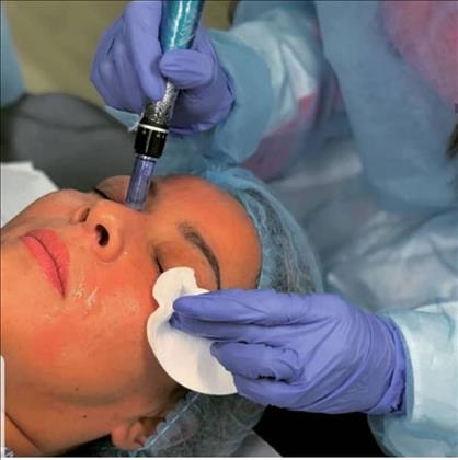 کلینیک زیبایی آلیس