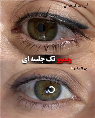 آرایش دائم فاطمه مالکی مشهد