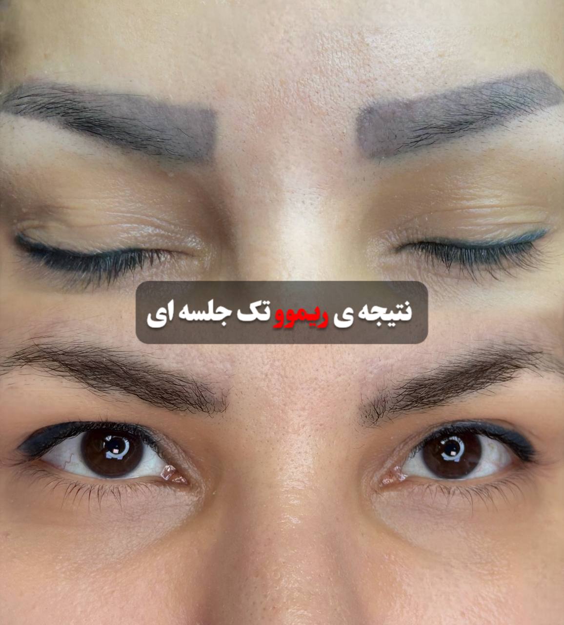 آرایش دائم فاطمه مالکی 9 آرایش دائم فاطمه مالکی 9