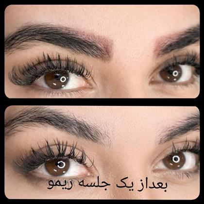 ستین