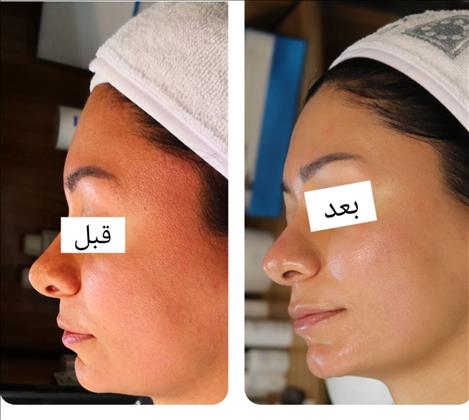 مرکز تخصصی فیشیال درمانی و مراقبت پوستی پارلا