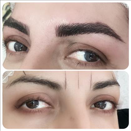 میکرو اِلیمو