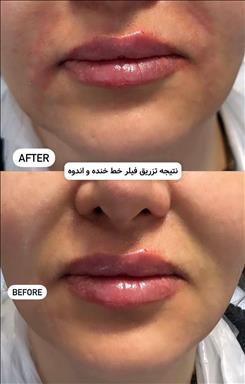 کلینیک پوست و مو رویال وی آی پی 1