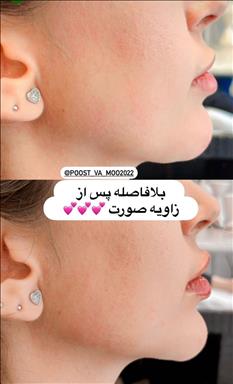 کلینیک پوست و مو رویال وی آی پی 3