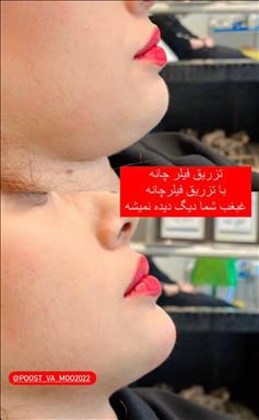 کلینیک پوست و مو رویال وی آی پی 4