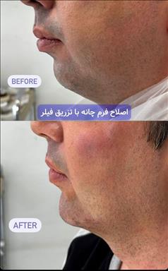 کلینیک پوست و مو رویال وی آی پی 5