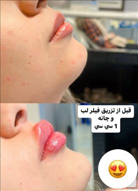 کلینیک پوست و مو رویال وی آی پی 11