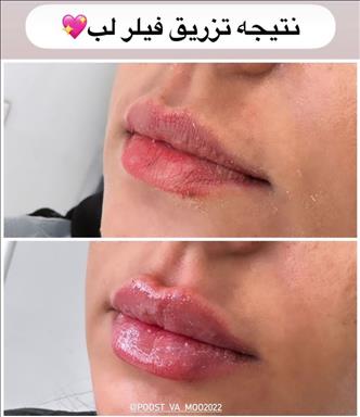 کلینیک پوست و مو رویال وی آی پی 13