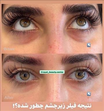 کلینیک پوست و مو رویال وی آی پی 14