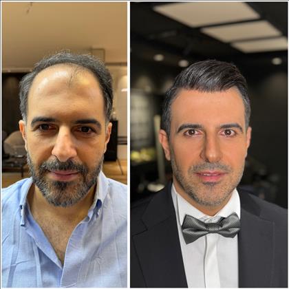 سالن داماد مهدی نوژن